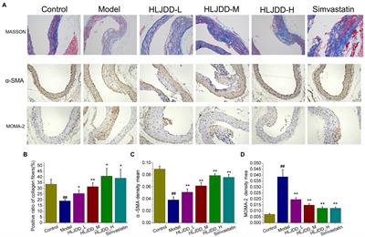 Huang-Lian-Jie-Du Decoction Attenuates Atherosclerosis and Increases Plaque Stability in High-Fat Diet-Induced ApoE-/- Mice by Inhibiting M1 Macrophage Polarization and Promoting M2 Macrophage Polarization